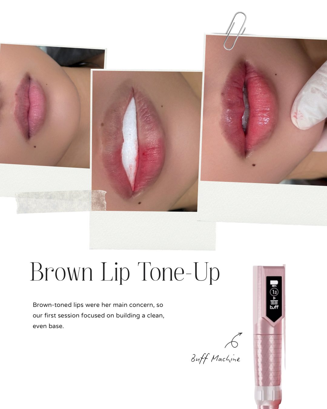Brown lip tone-up, session one