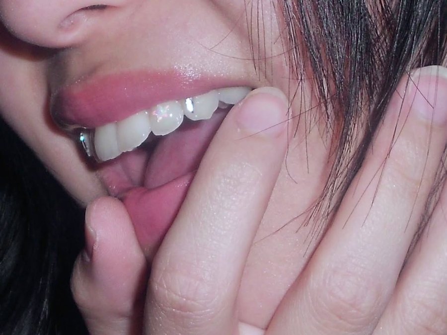 Tooth gems close up