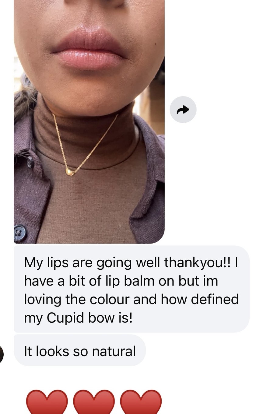 Client message about lip colour and cupid bow